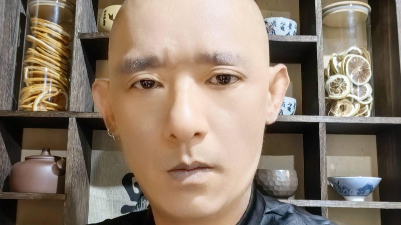 针灸减肥和拔罐减肥：探寻减肥方法背后的中医智慧